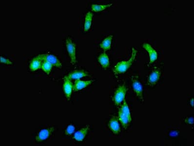 IHC-plus™ Polyclonal Rabbit anti-Human PCK1 Antibody (IHC, WB)
