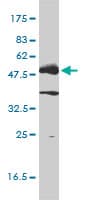Monoclonal Mouse anti-Human p56lck / LCK Antibody (clone 3F7-F5, WB)