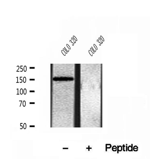 CEMIP / KIAA1199 Antibody