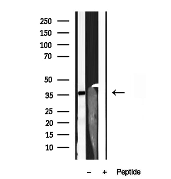 AIMP2 Antibody