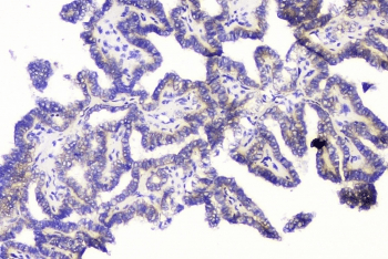 Polyclonal Rabbit anti-Human RRBP1 / hES Antibody (IHC, WB)