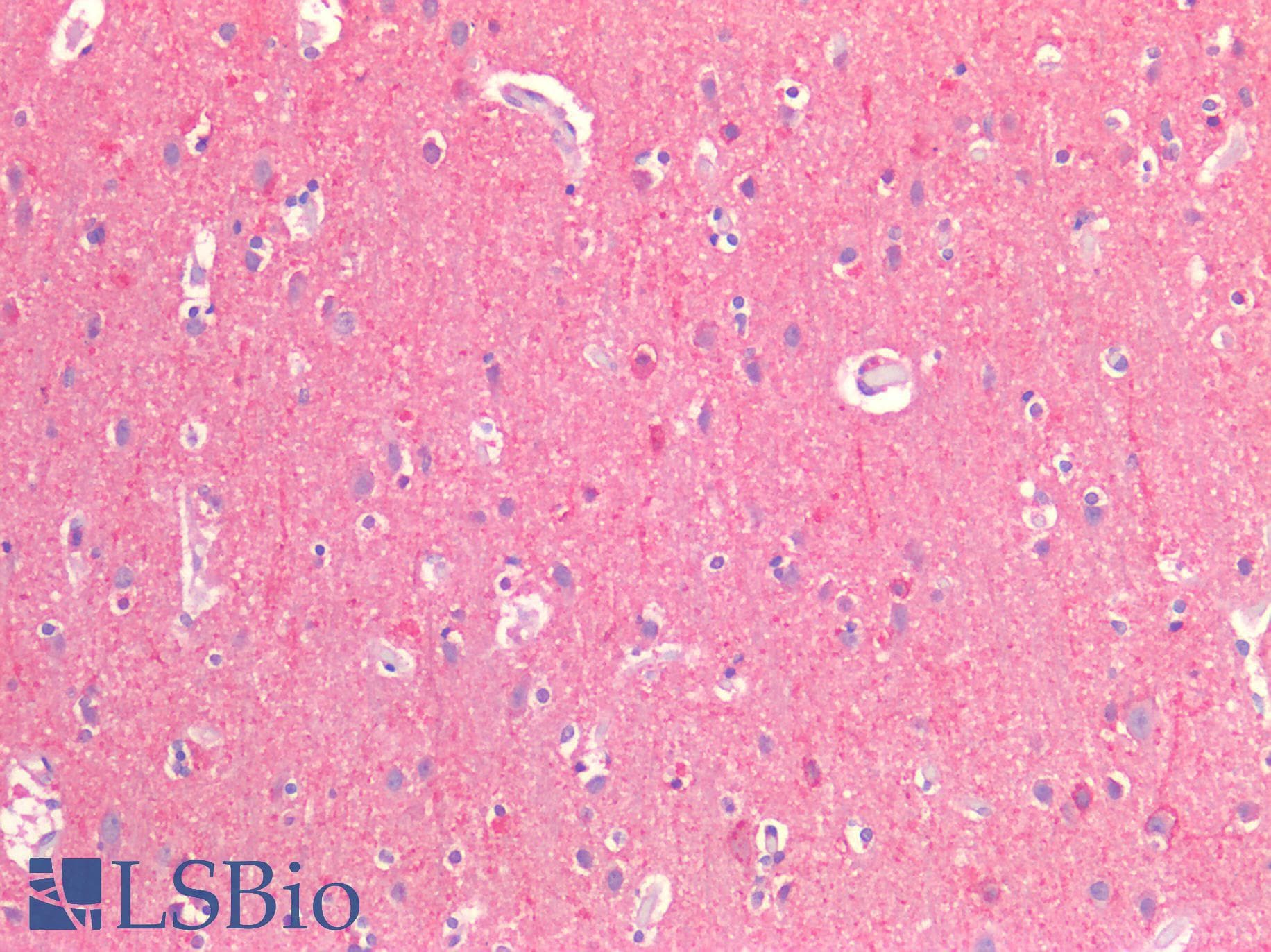 IHC-plus™ Polyclonal Rabbit anti-Human CD81 Antibody (IHC)