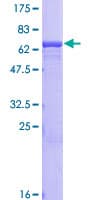 Human NPTX2 Protein (Recombinant GST)