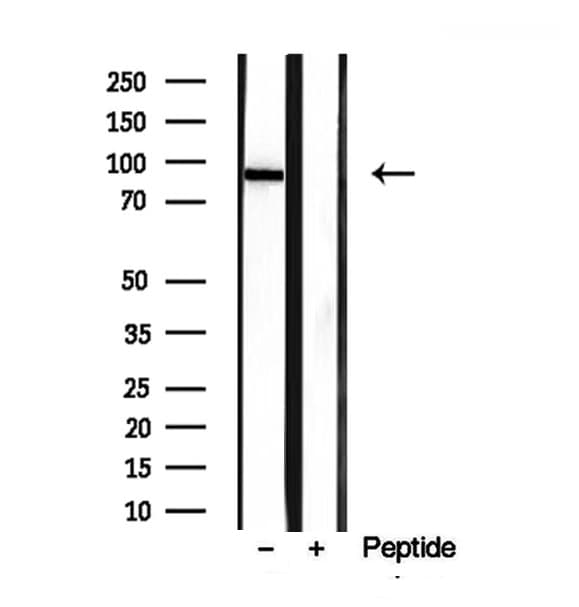 PLOD2 Antibody