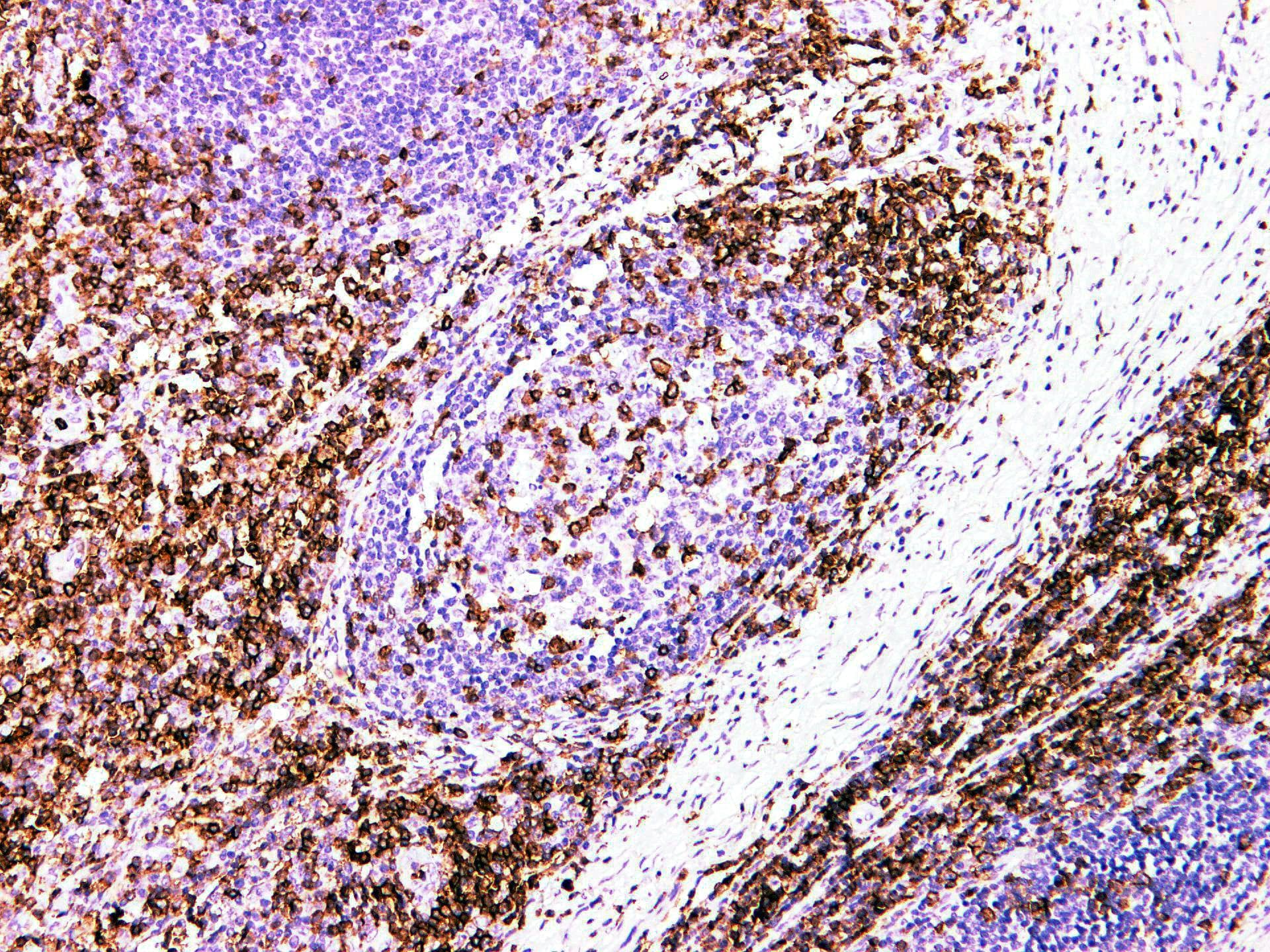 SPN / CD43 Antibody