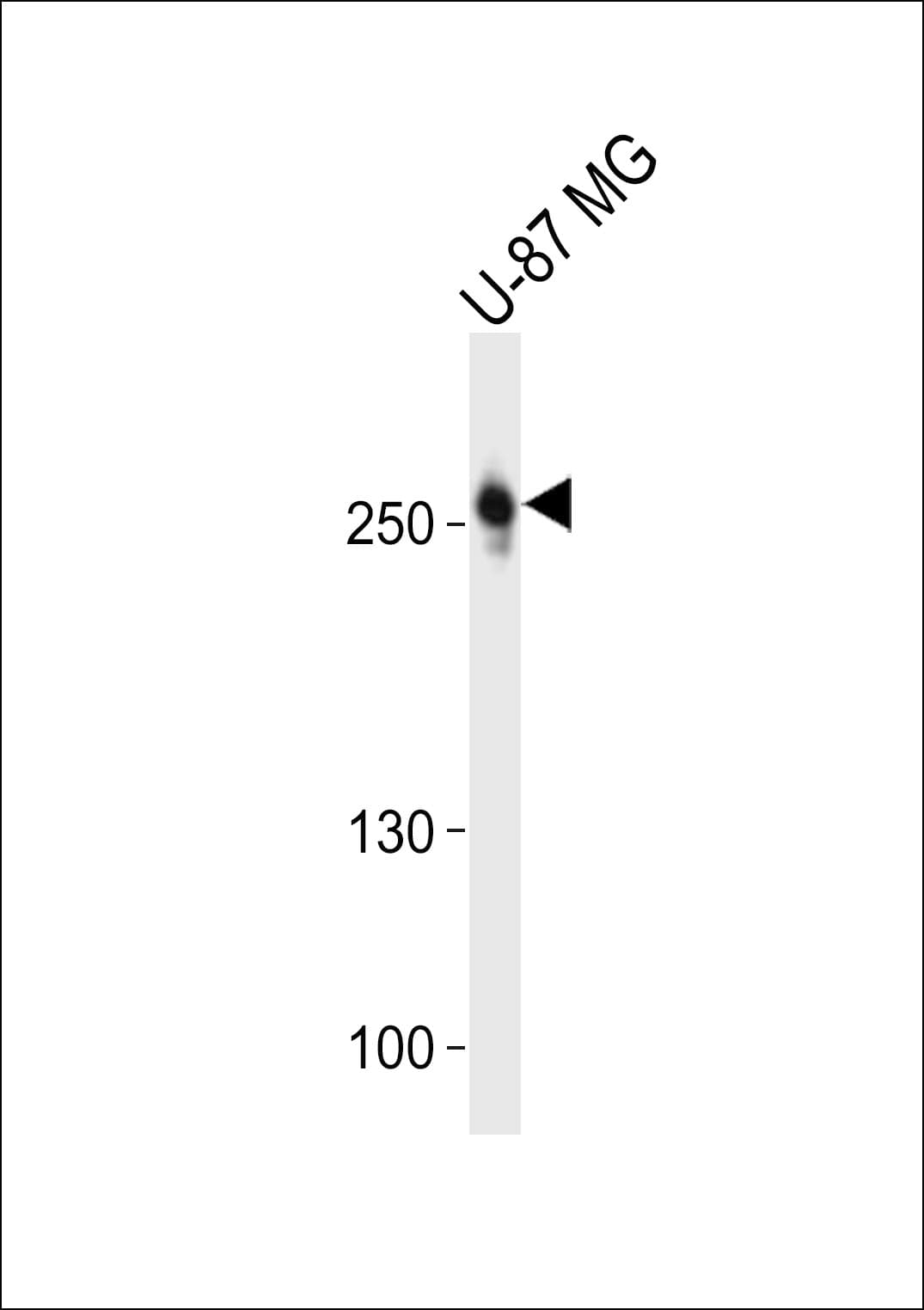 PathPlus™ ROS1 / ROS Antibody (aa1744-1777)