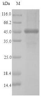 Human CNN2 Protein (Recombinant 6His-SUMO, N-terminus)