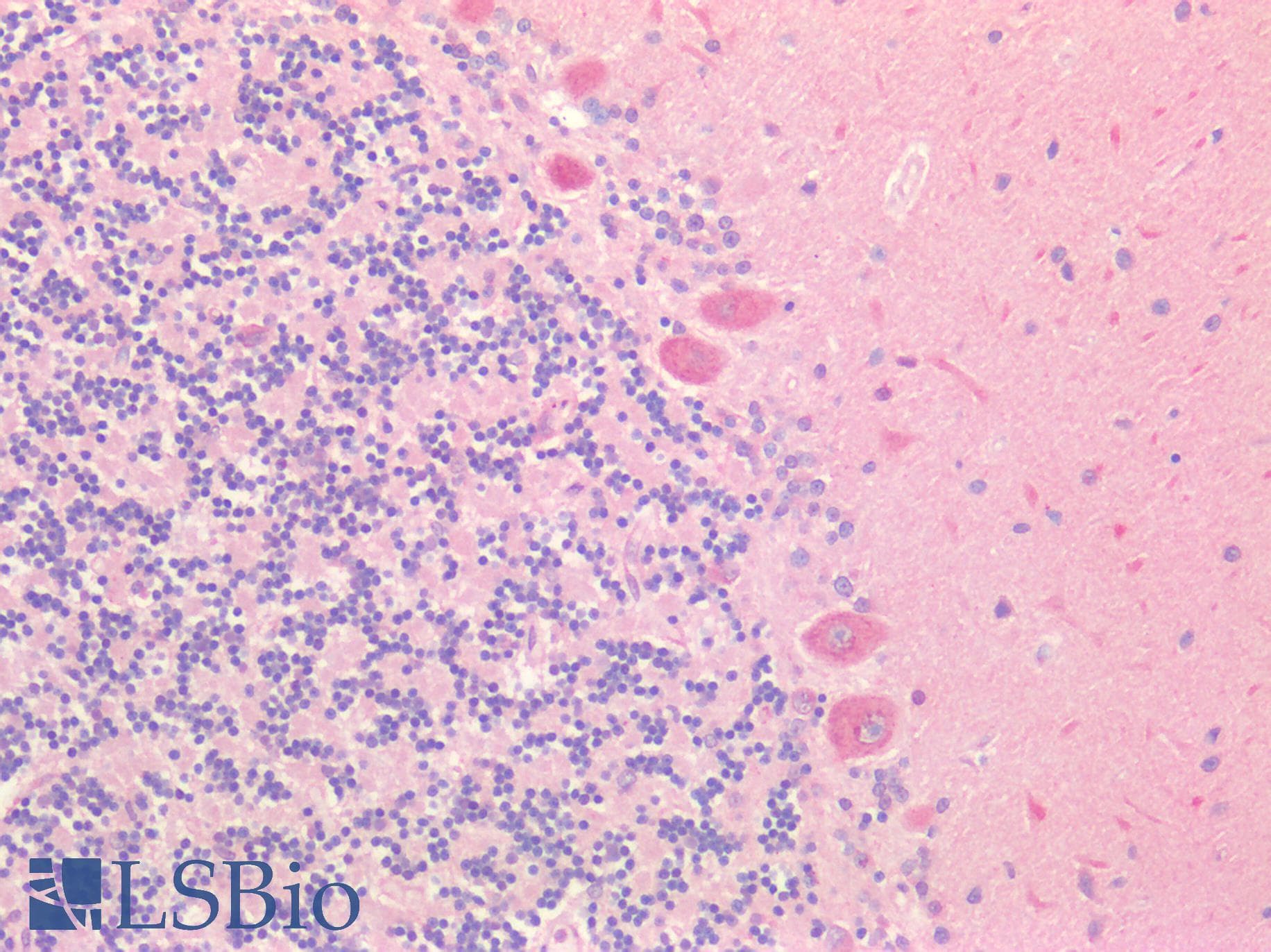 IHC-plus™ TH / Tyrosine Hydroxylase Antibody