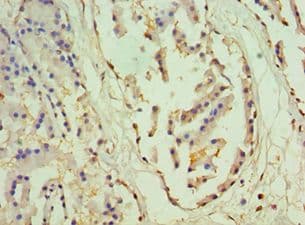 Polyclonal Rabbit anti-Human OTX2 Antibody (aa140-280, IHC)