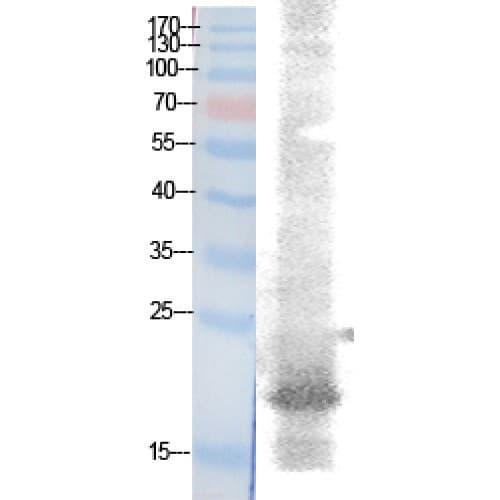 NFE4 / NF-E4 Antibody (around the acetylation site of K43.)