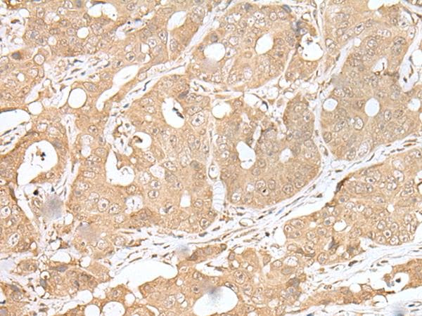 Polyclonal Rabbit anti-Human SMARCA1 / SWI Antibody (IHC, WB)