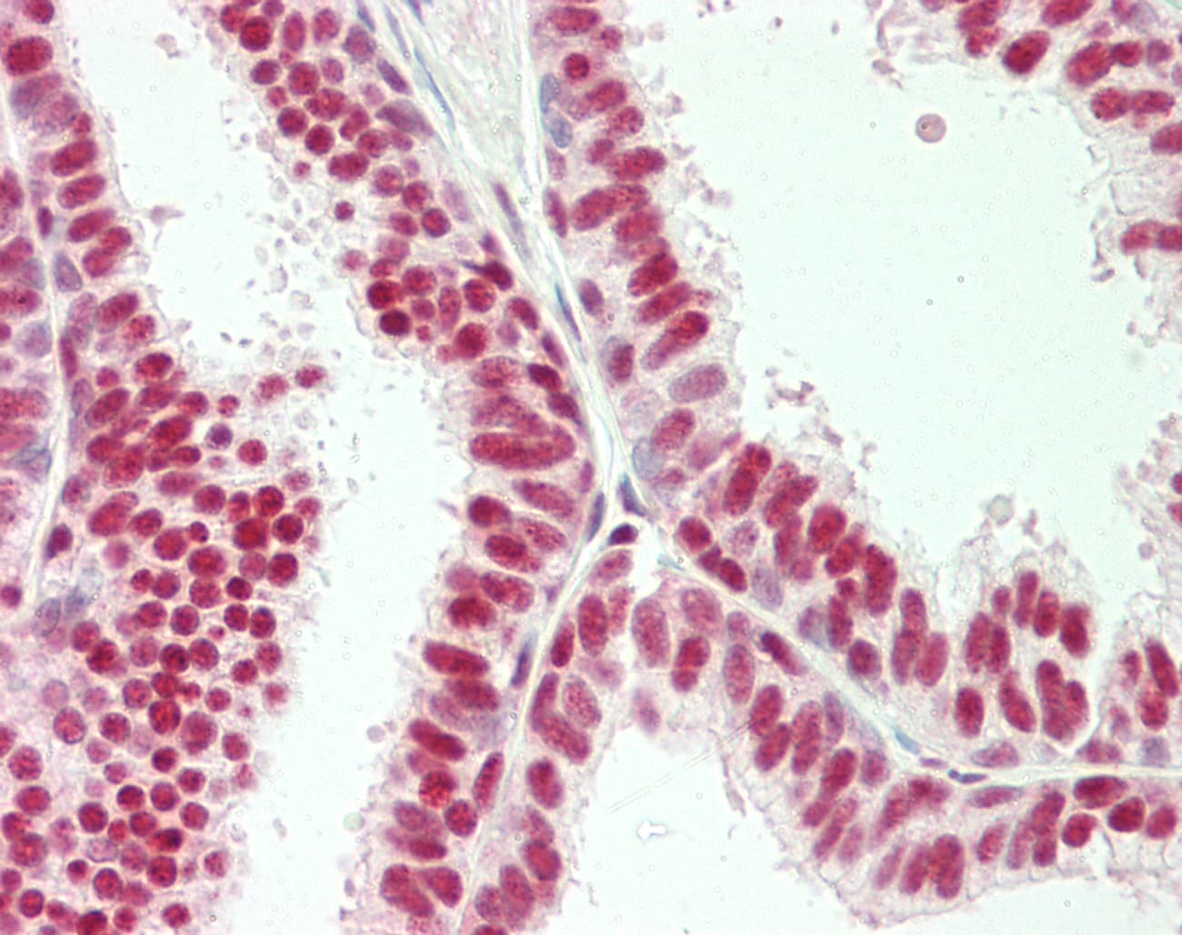 PathPlus™ Polyclonal Rabbit anti-Human APOBEC3B Antibody (IHC, IF, WB)