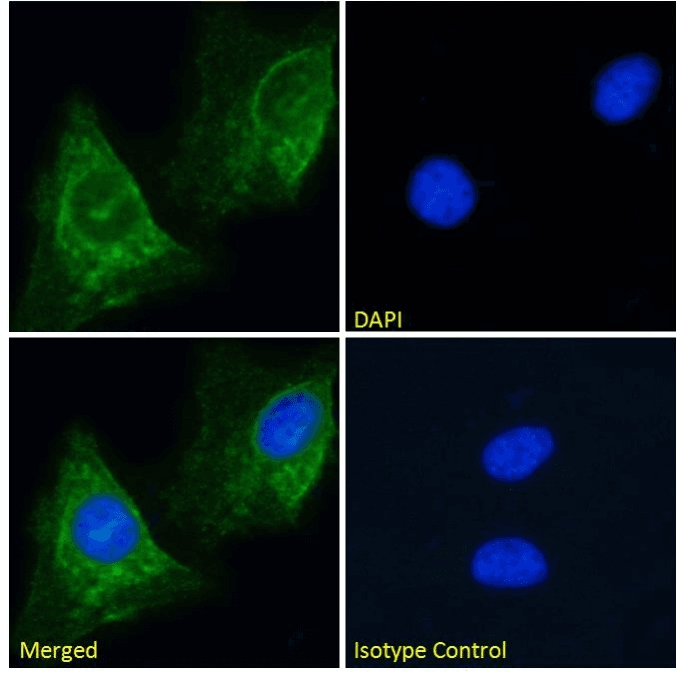 Recombinant Monoclonal Rat anti-Human CHRNA1 Antibody (clone mAb 192, Human Muscle Acetylcholine Receptor, WB)