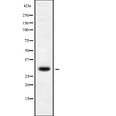 Polyclonal Rabbit anti-Human MRPS15 Antibody (IF, WB)