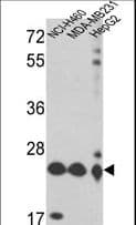 PRDX3 / Peroxiredoxin 3 Antibody (aa66-94)