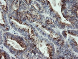 APP / Beta Amyloid Precursor Antibody (clone OTI7A10, Carrier-free)