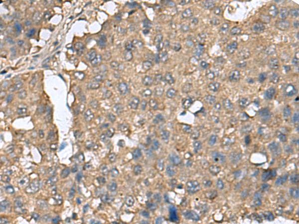 Polyclonal Rabbit anti-Human EIF4A2 Antibody (IHC)