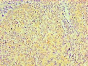 Monoclonal Mouse anti-Human CD81 Antibody (clone 2E11E5, IHC)