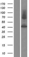 P2RX2 / P2X2 Protein (Over-Expression Lysate Myc-DDK (Flag))