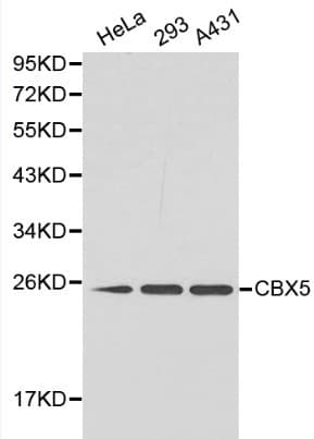 Polyclonal Rabbit anti-Human CBX5 / HP1 Alpha Antibody (IHC, WB)
