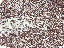 NONO / P54NRB Antibody (clone OTI3F8)