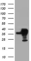 SERPINB1 Antibody (aa77-306, clone OTI1D1, Carrier-free)