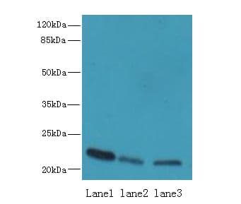 Polyclonal Rabbit anti-Human SSR3 / TRAP-Gamma Antibody (IHC, WB)