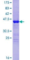 Human CYSRT1 / C9orf169 Protein (Recombinant GST)