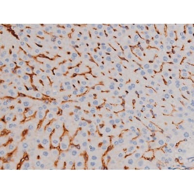 CDC25A Antibody (phospho-Ser75)