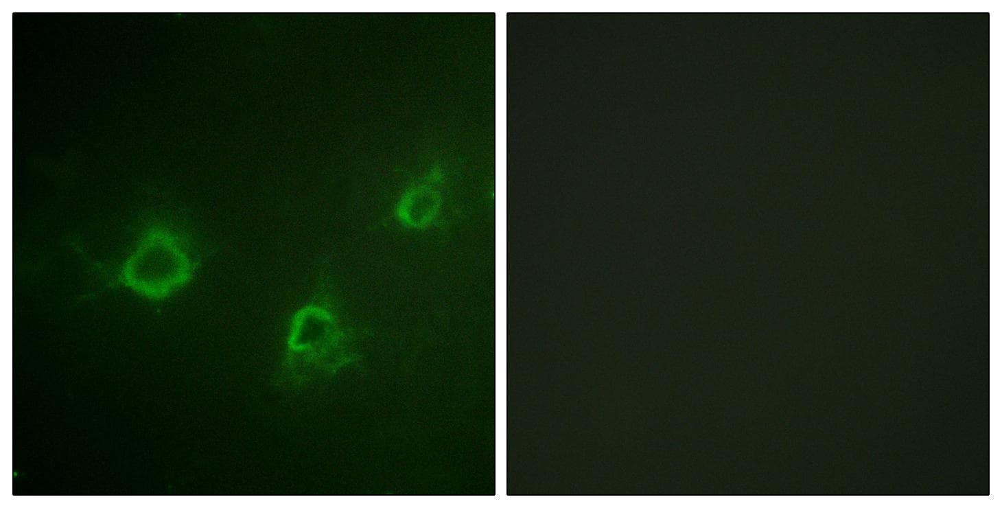 Polyclonal Rabbit anti-Human PLCG1 Antibody (Ab-1253, IF)