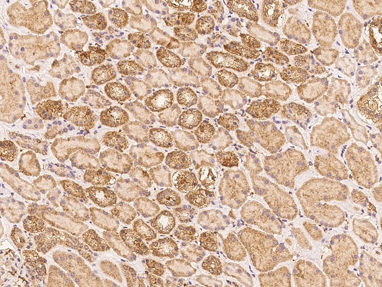 LRRK1 Antibody