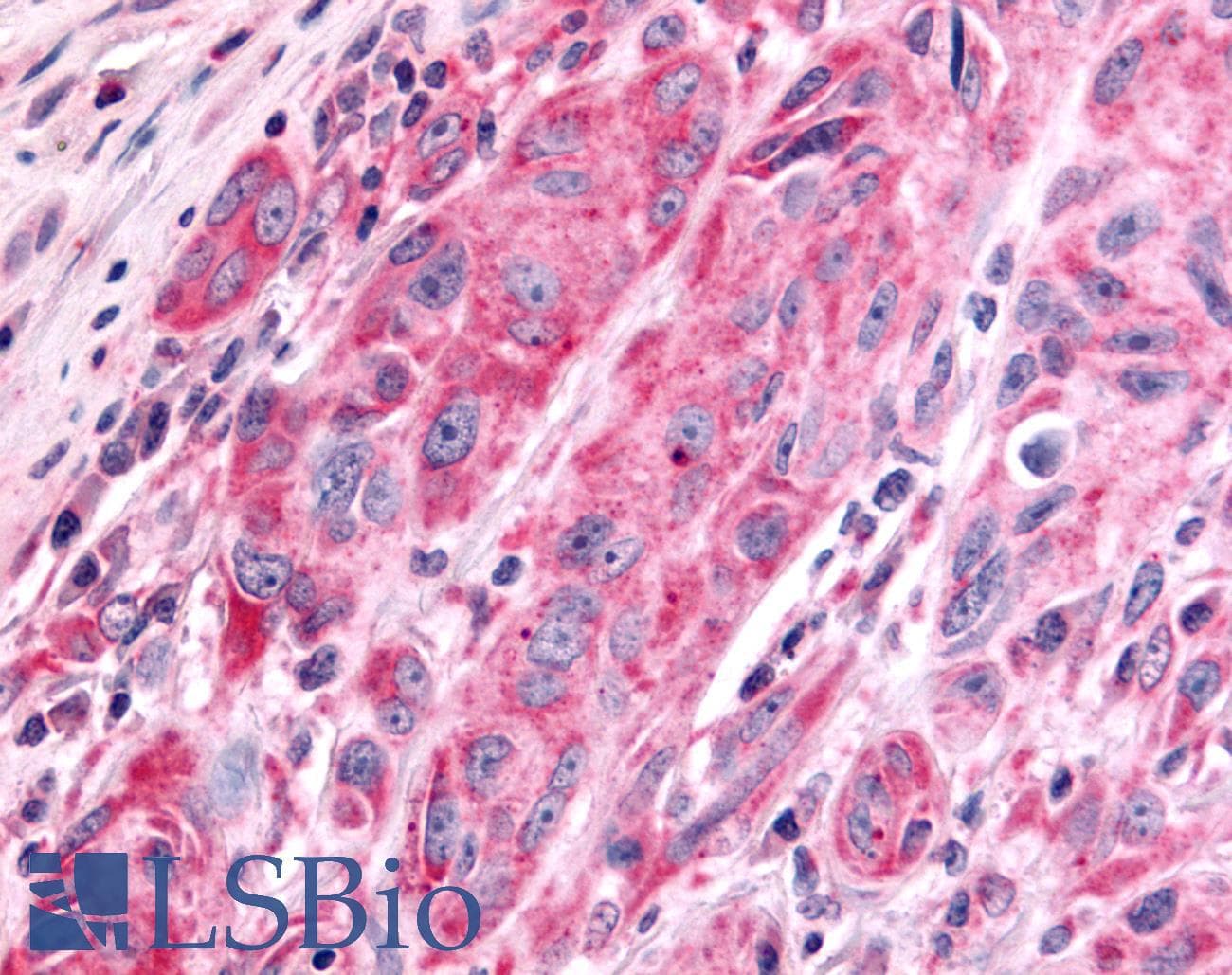 PathPlus™ PTPRE / PTP Epsilon Antibody (Cytoplasmic Domain)