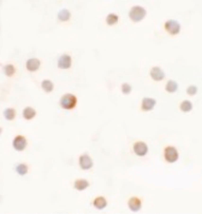 ABCA1 Antibody