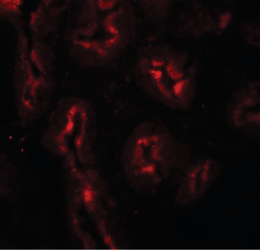Polyclonal Rabbit anti-Human AP3S1 Antibody (IHC, IF, WB)