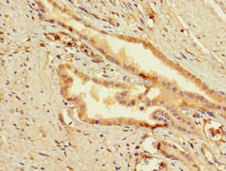 SLC25A10 / DIC Antibody