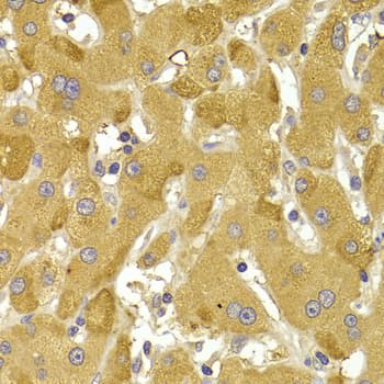 Polyclonal Rabbit anti-Human SNAI2 / SLUG Antibody (IHC, IF, WB)