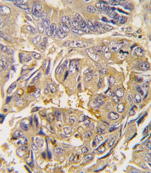 ATG16L1 / ATG16L Antibody (aa161-190)