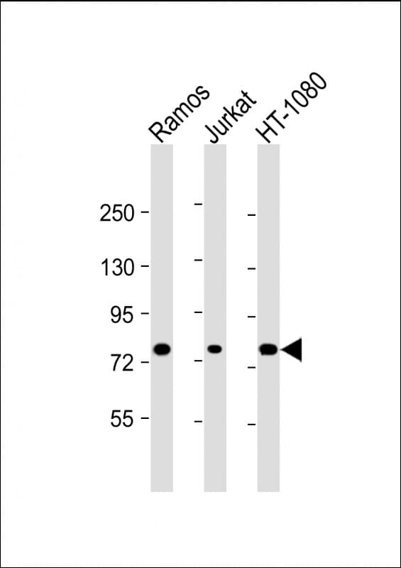 Monoclonal Mouse anti-Human GARS / Glycyl tRNA Synthetase Antibody (clone 1641CT258.1.2, WB)