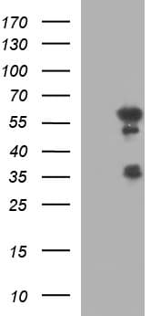 Monoclonal Mouse anti-Human IRF5 Antibody (clone OTI1G7, IHC, WB)