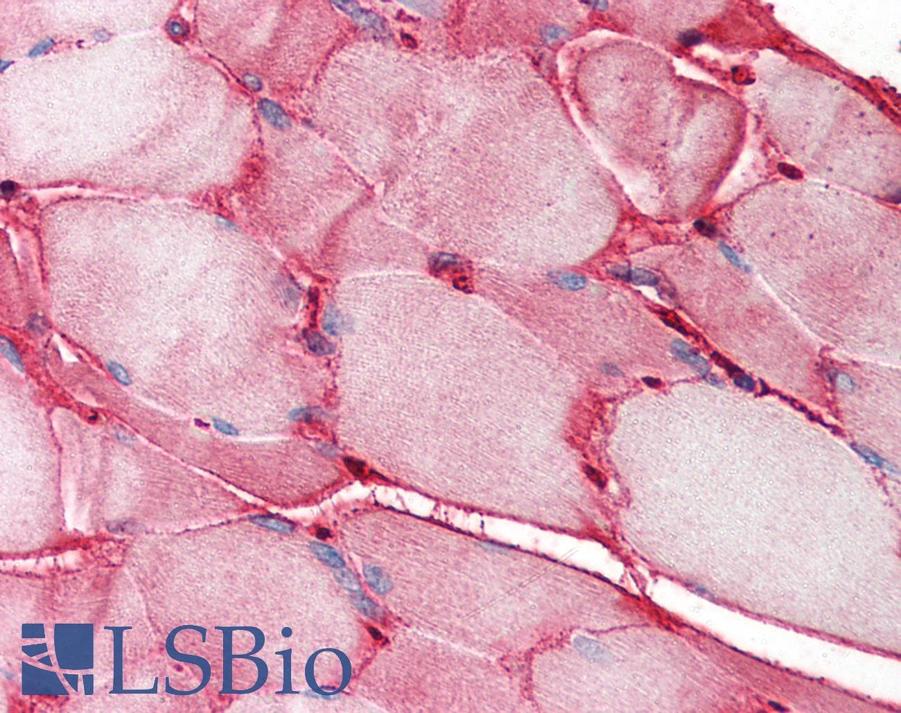 IHC-plus™ Polyclonal Rabbit anti-Human FN1 / Fibronectin Antibody (IHC, WB)