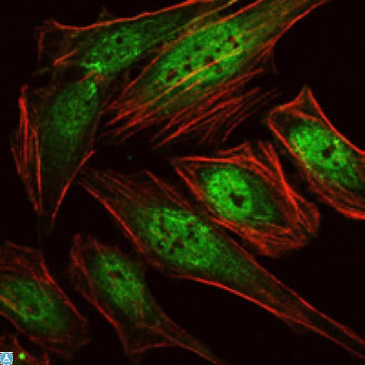 AML1 / RUNX1 Antibody