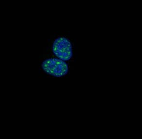 Polyclonal Rabbit anti-Human HIST1H1B Antibody (phospho-Thr154, WB)