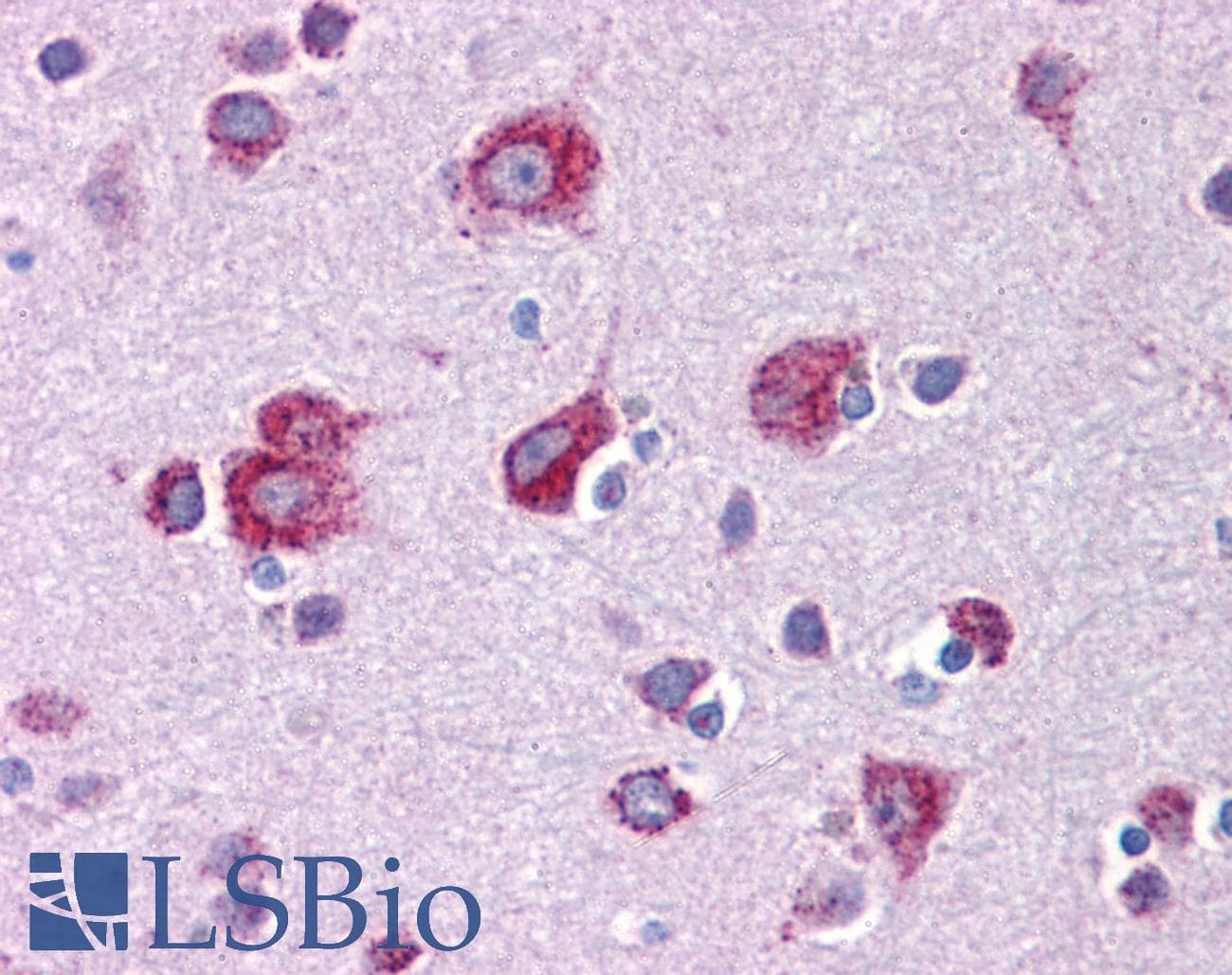 MFSD2A Antibody