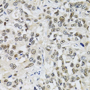Polyclonal Rabbit anti-Human TP53BP1 / 53BP1 Antibody (IHC, IF, WB)