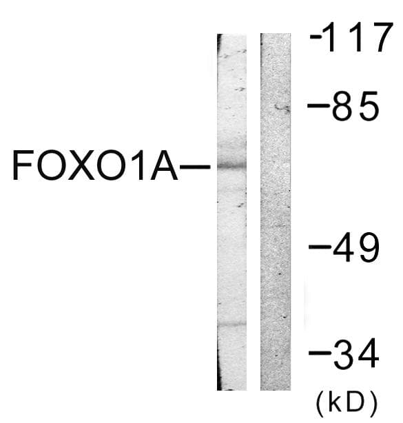 FOXO1 / FKHR Antibody (p329)