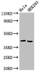 ARPC1A Antibody