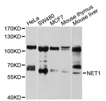 NET1 / ARHGEF8 Antibody