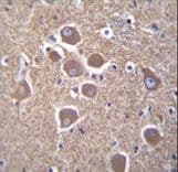 TUBB2B / Tubulin Beta 2B Antibody (aa12-39)