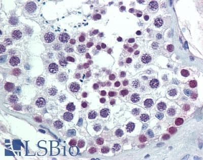 IHC-plus™ MGMT Antibody