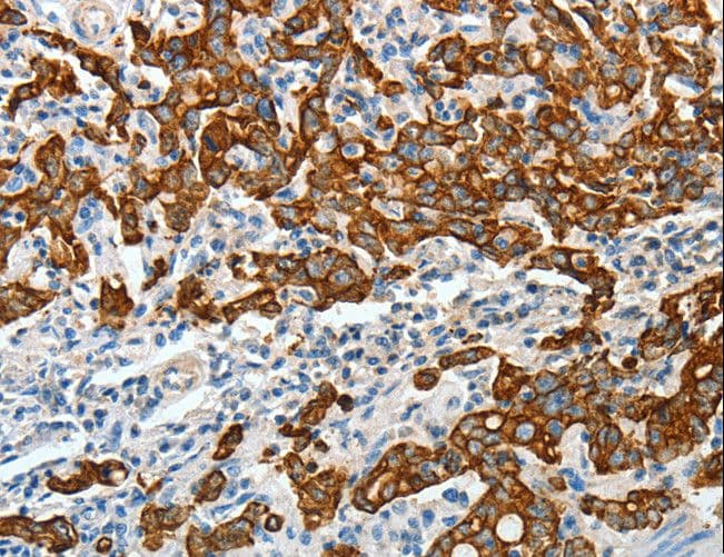 KRT18 / CK18 / Cytokeratin 18 Antibody